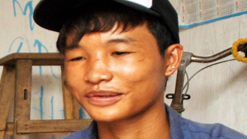 Lòng tốt, từ 'cổ tích' mơ mộng về bé Hào Anh