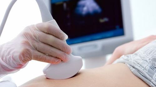 Phụ nữ mang thai cần xét nghiệm Zika khi nào?