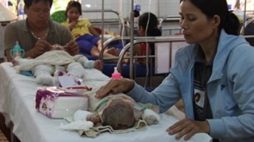 Thông tin sốc về vụ 5 người trong gia đình thương vong do bỏng xăng