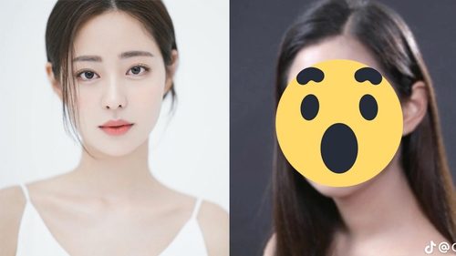 Lộ ảnh trước thẩm mỹ của Hoa hậu hot nhất 'Địa ngục độc thân 2', nhan sắc quá khác hiện tại!