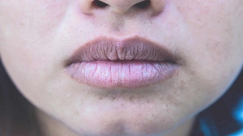 3 vùng trên cơ thể nữ giới chuyển sang màu đen có thể là dấu hiệu tử cung đang chất chứa nhiều độc tố