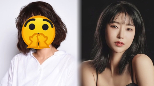 Bạn thân Duk Sun (Reply 1988) 'dao kéo' đại thành công, nhìn lại ảnh cũ mà ngã ngửa vì không tin đây là 1 người