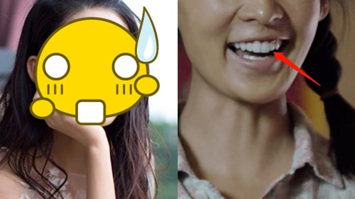 Dân tình đồng loạt đòi gỡ bỏ phim Trung này vì quá vô lý: Nữ chính nhà nghèo, không có tiền đi học mà... bọc răng sứ cả hàm!