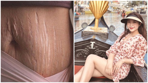 Vợ Phan Văn Đức đăng ảnh vết rạn sau sinh, nói lên tiếng lòng của người làm mẹ khiến cộng đồng mạng xúc động