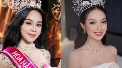 Nhan sắc lạ lẫm của Hoa hậu Thanh Thủy hậu công khai nâng mũi và 'trùng tu' vòng 1