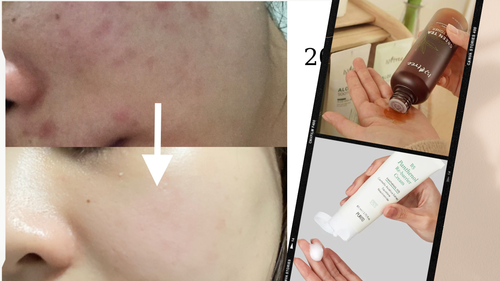 Tuân thủ 3 tips skincare, cô nàng giữ làn da láng mịn không mụn suốt 4 năm