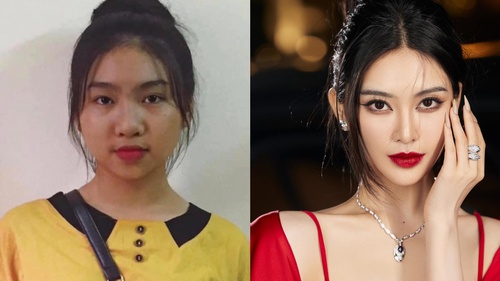 Lan truyền hình ảnh trước khi phẫu thuật thẩm mỹ của “bản sao Phạm Băng Băng”