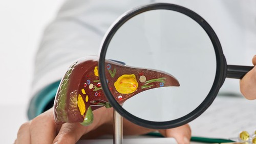 36 tuổi mắc ung thư gan, 'thủ phạm' là thứ quen mặt, nhiều người Việt mang trong người nhưng thờ ơ