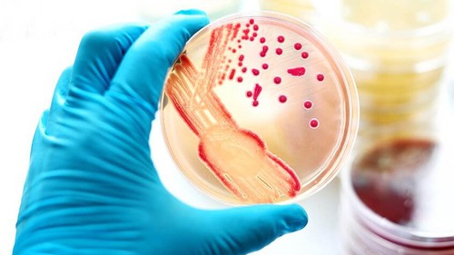 Chuyên gia y tế khuyến cáo các biện pháp phòng ngừa bệnh đậu mùa khỉ