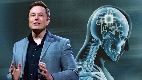 Neuralink khắc phục sự cố trong ca cấy chip đầu tiên vào não người