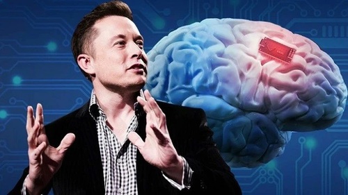 Mỹ: FDA 'bật đèn xanh' cho Neuralink tiếp tục thử nghiệm cấy ghép chip vào não người