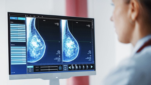 Công nghệ hình ảnh siêu nhạy giúp phát hiện ung thư sớm