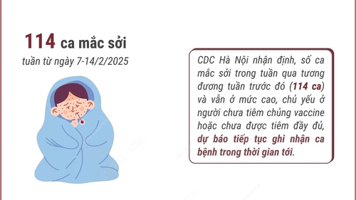 Hà Nội: Số ca mắc sởi vẫn ở mức cao