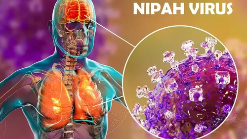 Việt Nam chưa xuất hiện ca mắc virus Nipah, Bộ Y tế sẵn sàng các biện pháp ứng phó