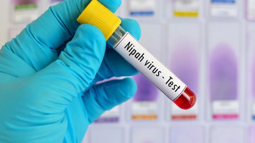 Ấn Độ ghi nhận ca tử vong do virus Nipah