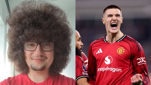 CĐV nổi tiếng của MU còn lâu mới được cắt tóc!