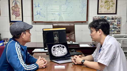 Kỳ tích sau 4 năm “thoát án tử” của bệnh nhân ung thư gan giai đoạn muộn