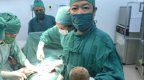 Lấy thành công viên sỏi gần nửa kg khỏi bàng quang bệnh nhân