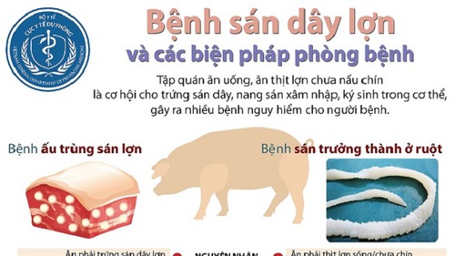 Bệnh sán dây lợn và các biện pháp phòng bệnh