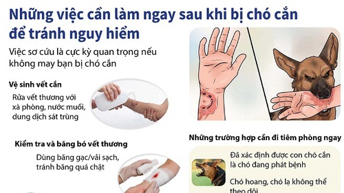 Những việc cần làm sau khi bị chó cắn để tránh nguy hiểm