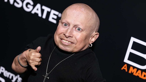 Sao tí hon đóng yêu tinh trong ‘Harry Potter’ Verne Troyer qua đời