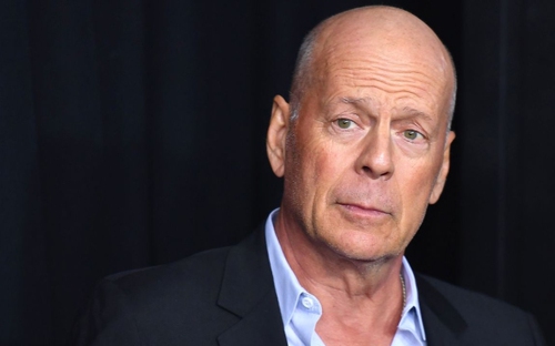 Bruce Willis mắc chứng sa sút trí tuệ