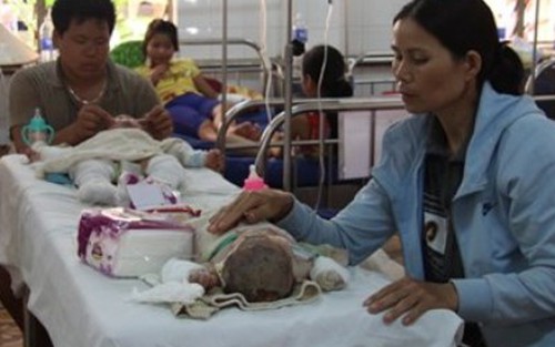 Thông tin sốc về vụ 5 người trong gia đình thương vong do bỏng xăng
