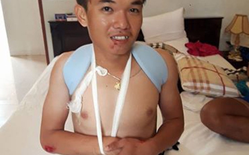 Con trai HLV Trần Văn Quýt té gãy xương vai trên đường tập