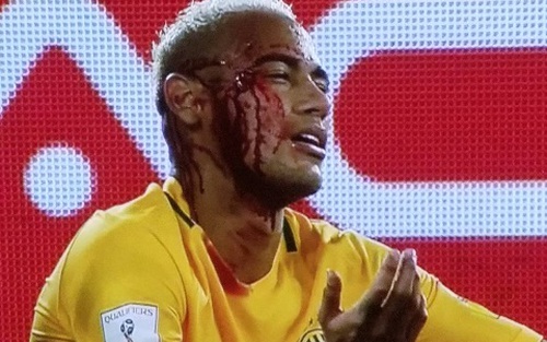 Brazil 5-0 Bolivia: Neymar bị đánh chảy máu trong ngày ghi bàn thứ 300 trong sự nghiệp