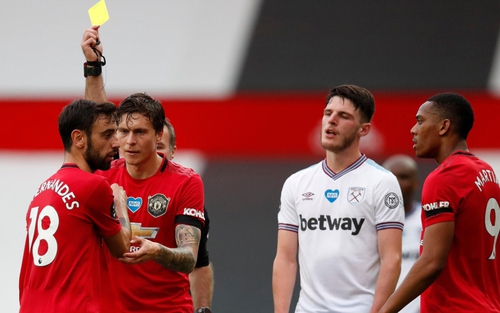 MU: Vắng Bruno Fernandes, Ten Hag xoay sở ra sao?