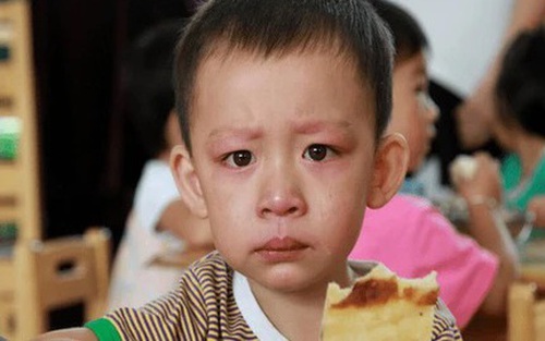 Cậu bé 8 tuổi thường xuyên chớp mắt, nhún vai, bố mẹ đưa đi khám thì bật khóc nức nở khi nghe nguyên nhân con mắc bệnh 