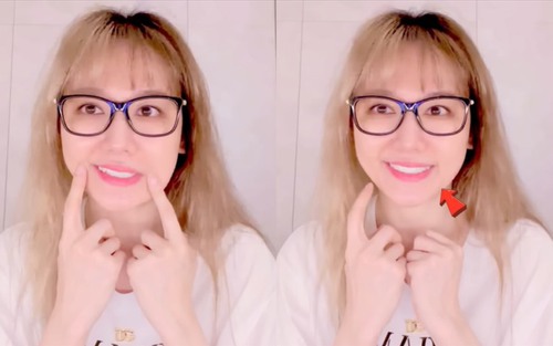 Tình trạng sức khoẻ đáng lo của Hari Won sau 4 tháng trị liệt nửa mặt 