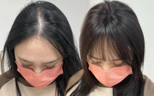 4 'cứu tinh' vớt vát mái tóc thưa mỏng, cắt hỏng khi Tết cận kề 