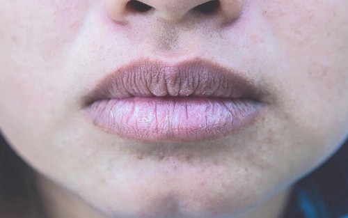 3 vùng trên cơ thể nữ giới chuyển sang màu đen có thể là dấu hiệu tử cung đang chất chứa nhiều độc tố
