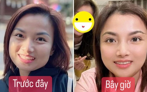 Cận cảnh nhan sắc Quỳnh Trần JP sau khi tiêm gọn hàm và nâng ngực, được dân mạng khen trẻ đẹp trông thấy