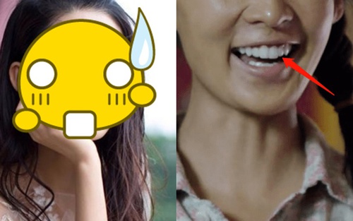 Dân tình đồng loạt đòi gỡ bỏ phim Trung này vì quá vô lý: Nữ chính nhà nghèo, không có tiền đi học mà... bọc răng sứ cả hàm!