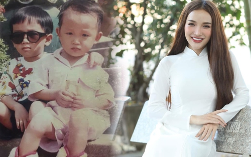Phẫu thuật 10 lần, chàng trai Đồng Nai “hóa” mỹ nhân, bố mẹ mở lòng đón nhận sau thời gian nghĩ con bị tâm thần