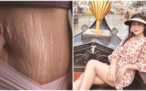Vợ Phan Văn Đức đăng ảnh vết rạn sau sinh, nói lên tiếng lòng của người làm mẹ khiến cộng đồng mạng xúc động