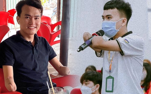 Nghỉ học kiếm tiền phụ gia đình, chàng trai khoẻ mạnh bỗng chốc cụt 2 tay, nỗ lực “hồi sinh” sau lần bị đói