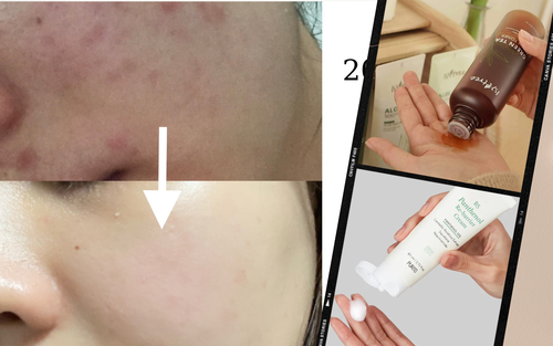 Tuân thủ 3 tips skincare, cô nàng giữ làn da láng mịn không mụn suốt 4 năm