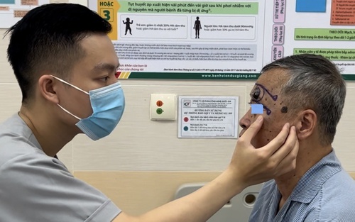 5 dấu hiệu của nốt ruồi cảnh báo ung thư, có 1 nên đi khám sớm