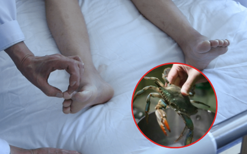 Tiếc rẻ một loại thực phẩm nhiều người yêu thích, người đàn ông suýt mất hai chân
