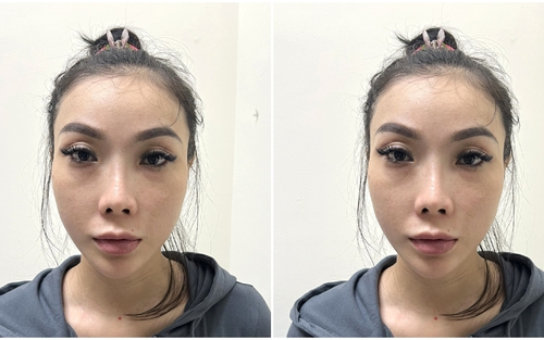 Bắt giữ đối tượng bị truy nã khi đang chuẩn bị xuất cảnh