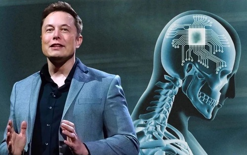 Neuralink khắc phục sự cố trong ca cấy chip đầu tiên vào não người