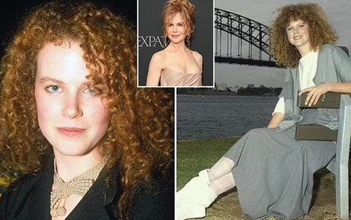 Nicole Kidman đột phá vào Hollywood nhờ lời chế giễu tàn nhẫn thời thơ ấu