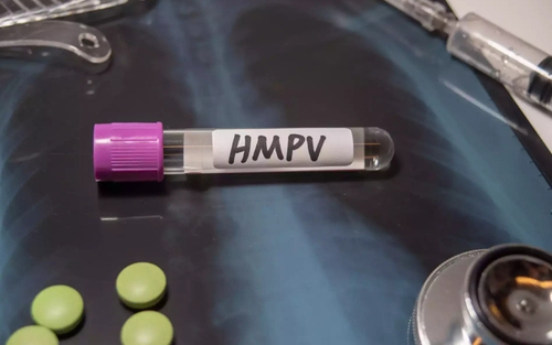 Nga xác định các nhóm nguy cơ nhiễm virus HMPV