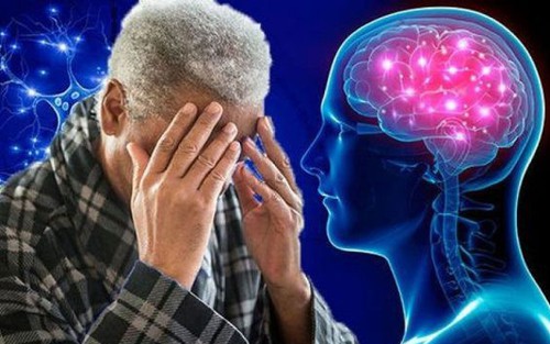 Bệnh sa sút trí tuệ trở thành nguyên nhân gây tử vong hàng đầu ở Australia