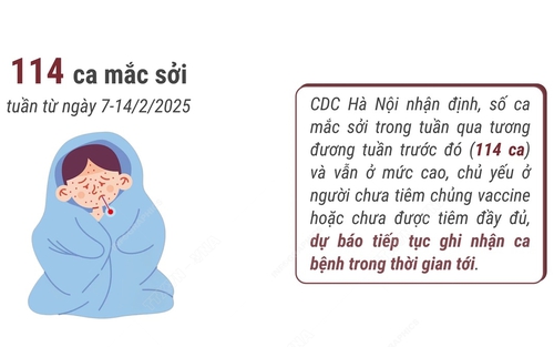 Hà Nội: Số ca mắc sởi vẫn ở mức cao