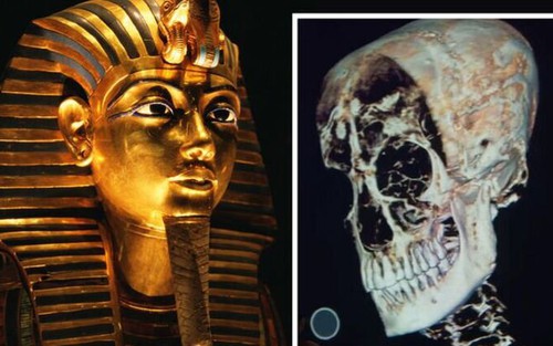 Phát hiện đột phá về cái chết của Vua Tutankhamun nhờ phân tích DNA