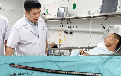 Xuyên đùi bởi xà beng 1,5m: Ca cấp cứu cân não tại Bệnh viện Việt Đức